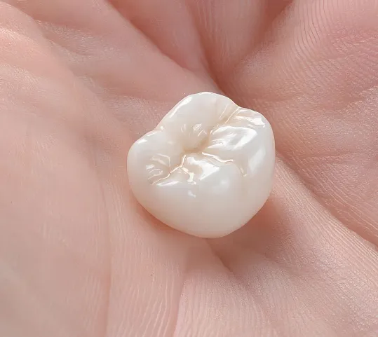 Dental Crowns at Northwest Center for Prosthodontics