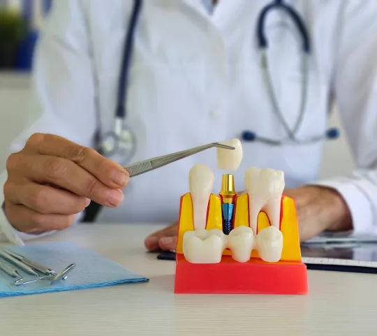 Dental Implants at Northwest Center for Prosthodontics