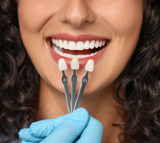 Dental Veneers at Northwest Center for Prosthodontics
