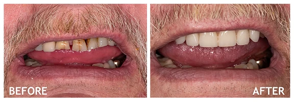 Before and After photos