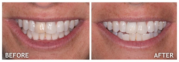 Before and After photos