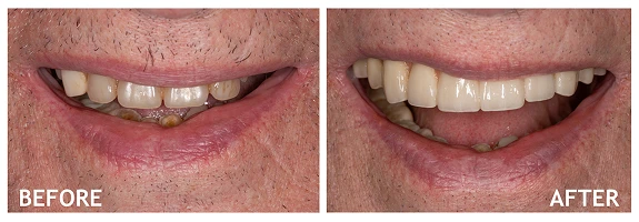 Before and After photos