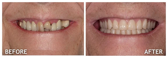 Before and After photos