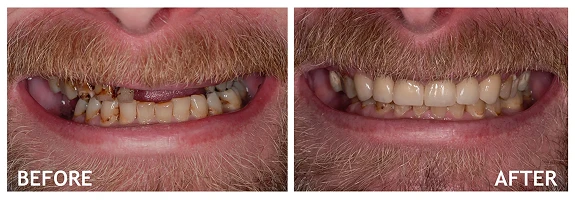 Before and After photos